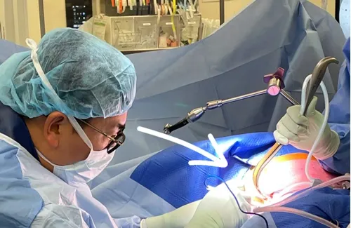 Surgeon operating through a small anterolateral incision in a fully draped surgical field