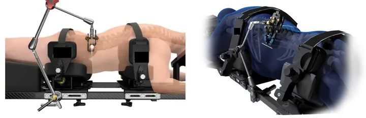 Two manufacturer renderings of a prone spinal positioning frame with side padding and support straps mounted on an operating table